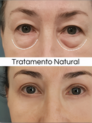 Creme Anti Olheiras - LumiEyes Collagen - 3 em 1